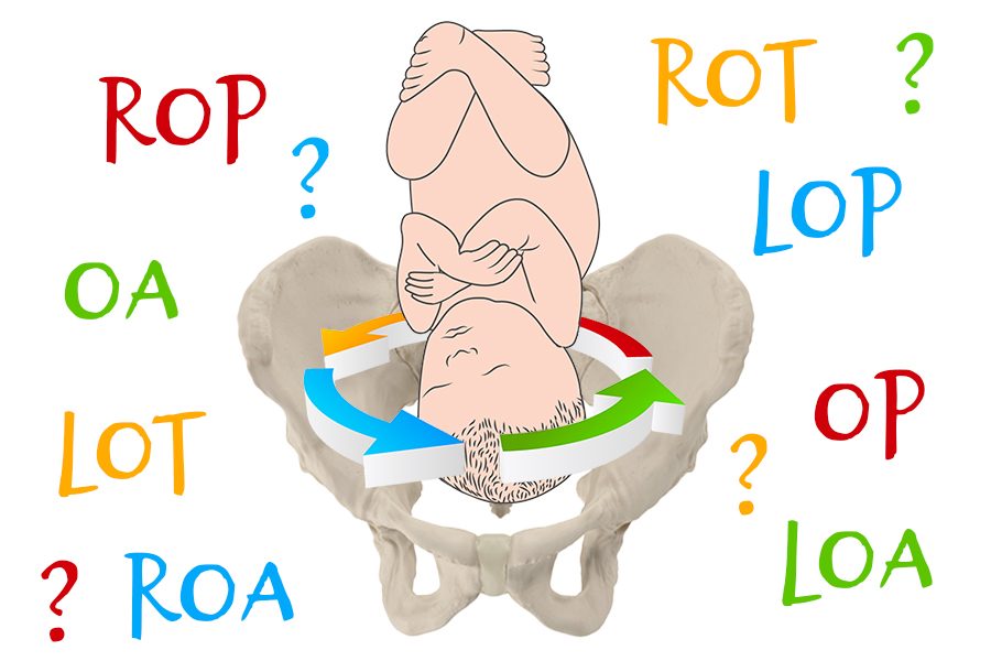 Head Down baby with arrows showing roation and abbreviations for different positions around